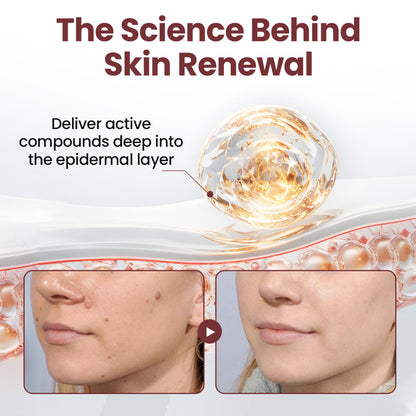 ✅Flash Sale - Action Renewal Cream