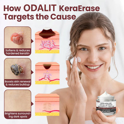 ✅Flash Sale - Action Renewal Cream