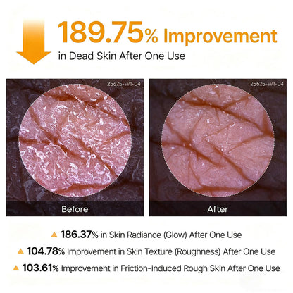 Peel Shot - Kojic + Turmeric Body Peel Spray