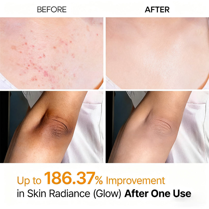 Peel Shot - Kojic + Turmeric Body Peel Spray